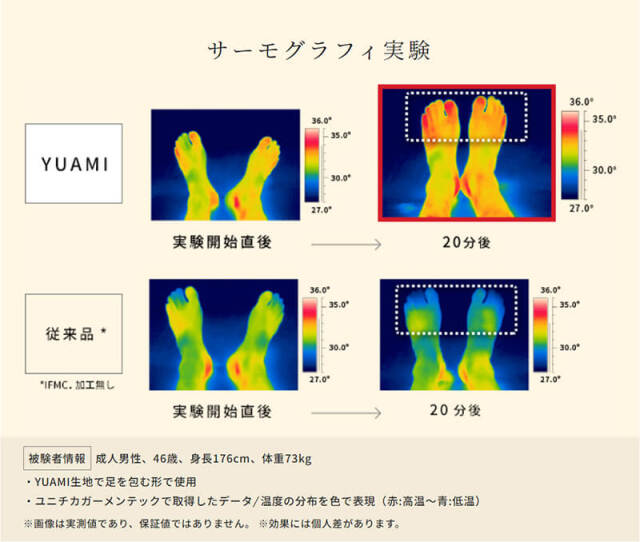 イフミック（IFMC.）とは